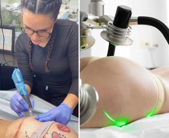 Side-by-side comparison of Elena Sanchez, Master Scar Camouflage Artist, performing scar camouflage on the left and a woman undergoing laser therapy on the right.