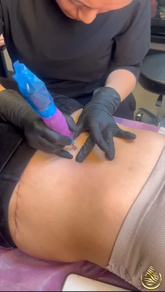 Artit tattooing a realistic 3D belly button on a client’s abdomen at Illusions by Ink Studio using paramedical tattooing techniques.